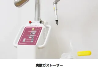 ヤマモト皮膚科　炭酸ガスレーザーによるほくろ・いぼ除去　施術メニュー画像