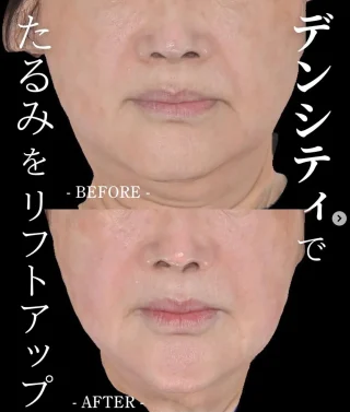 デンシティ