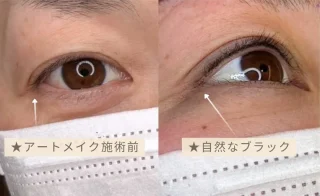 アートメイク（アイライン）