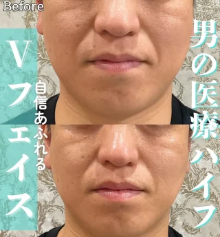 オーダーメイド医療ハイフ