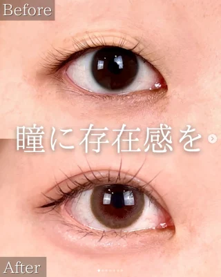 TCB式1dayクイックアイ