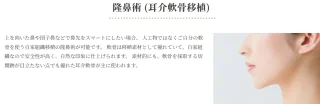 はらクリニック　隆鼻術 (耳介軟骨移植)　施術メニュー画像