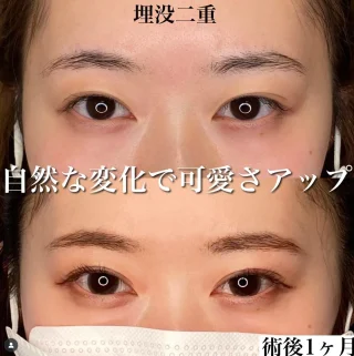埋没二重