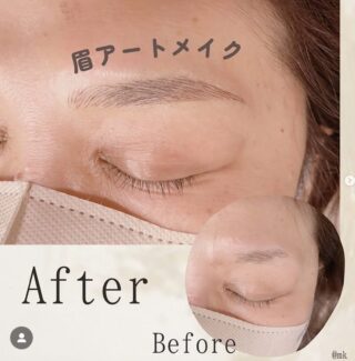 医療アートメイク