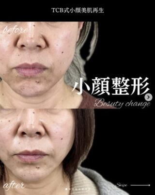 TCB式⼩顔美肌再⽣