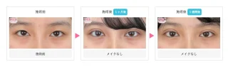 クイックコスメティーク・ダブルNeo