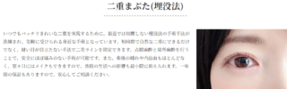 はらクリニック　二重まぶた（埋没法）　施術メニュー画像