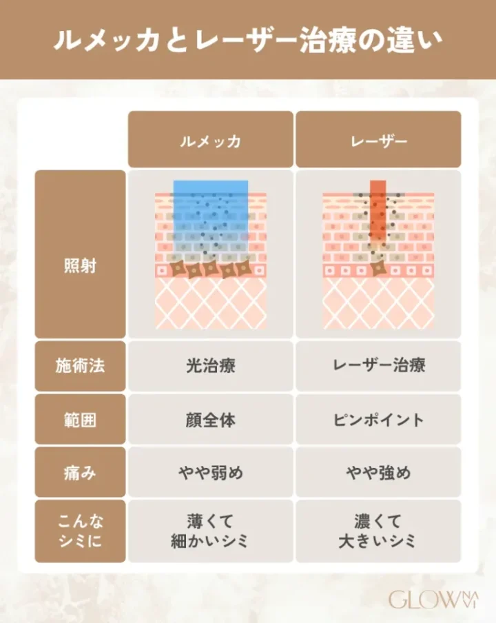 ルメッカとレーザー治療の違い
