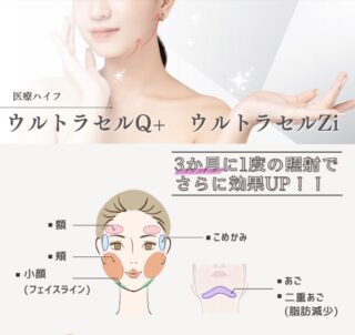 青森タウン形成外科クリニック 医療ハイフ 施術メニュー画像