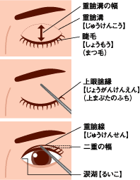 クリスタルメンズクリニック　部分切開法　施術メニュー画像