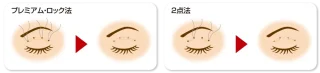 藤井美容外科(埋没)