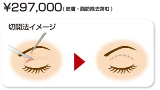 藤井美容外科(切開)