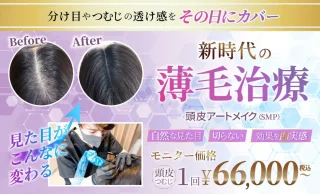 モアクリニック（頭皮アートメイク）