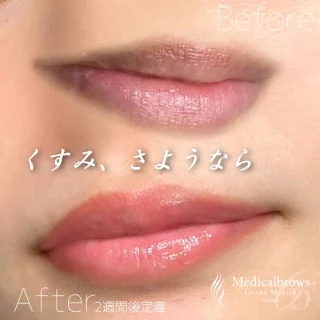 リップアートメイク(グローバルグランドマスター)