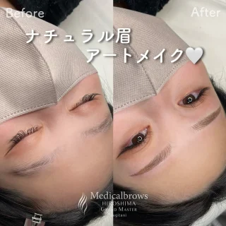 眉アートメイク(グローバルグランドマスター)