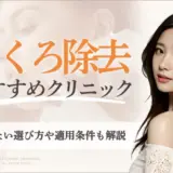 ほくろ除去おすすめクリニック｜アイキャッチ