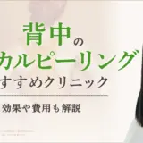 背中のケミカルピーリングおすすめクリニック　アイキャッチ画像