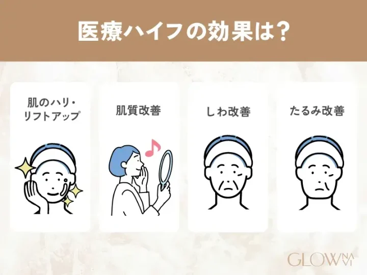 医療ハイフ　効果