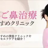 いちご鼻治療におすすめのクリニック　アイキャッチ画像