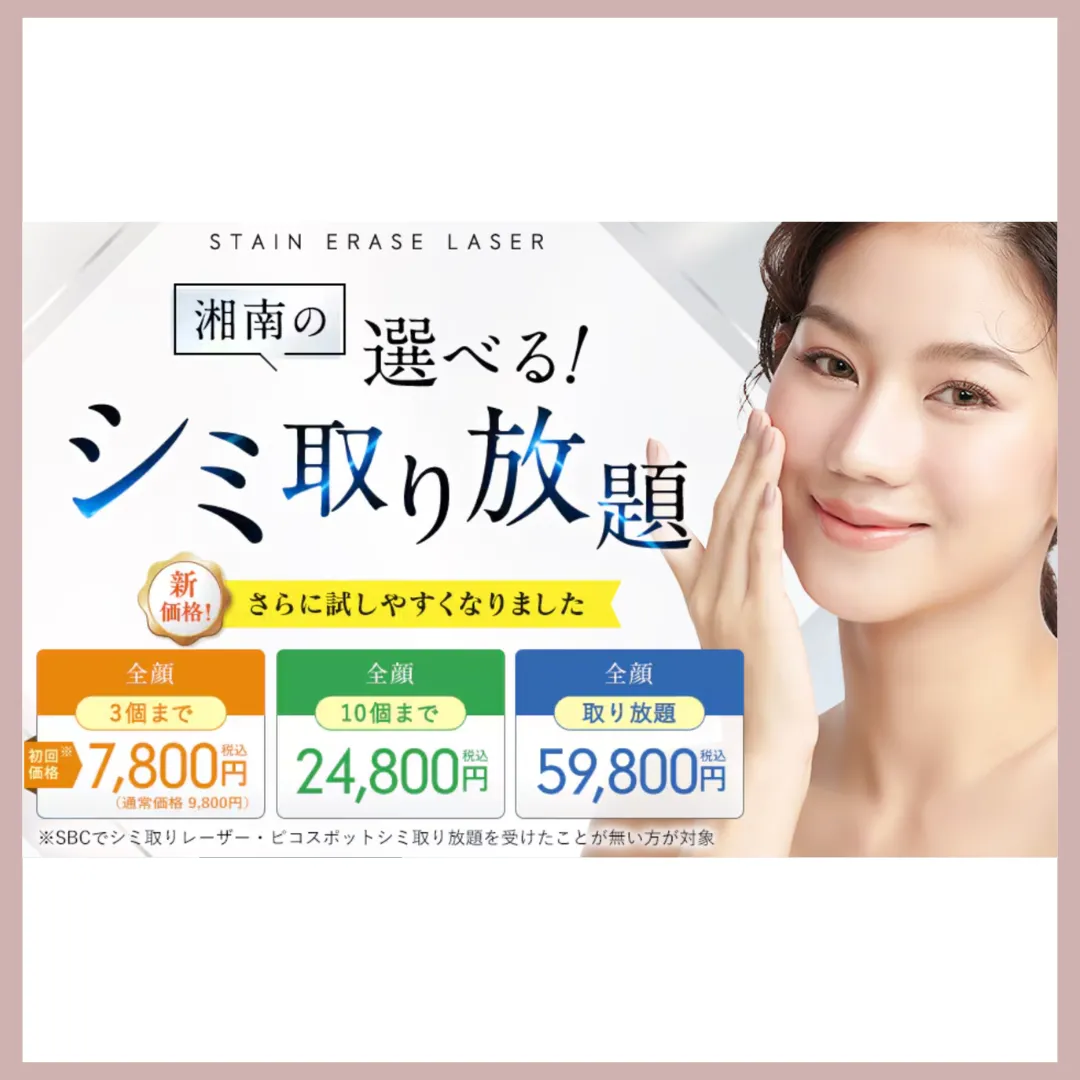 TCBシミ取り放題バナー
