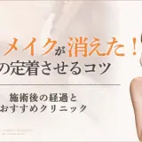 1回目のアートメイクがすぐ消えた理由！色を定着させるコツ・対処法　のアイキャッチ画像