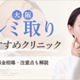 大阪でシミ取りがおすすめなクリニック　アイキャッチ画像