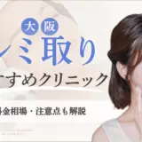 大阪でシミ取りがおすすめなクリニック　アイキャッチ画像