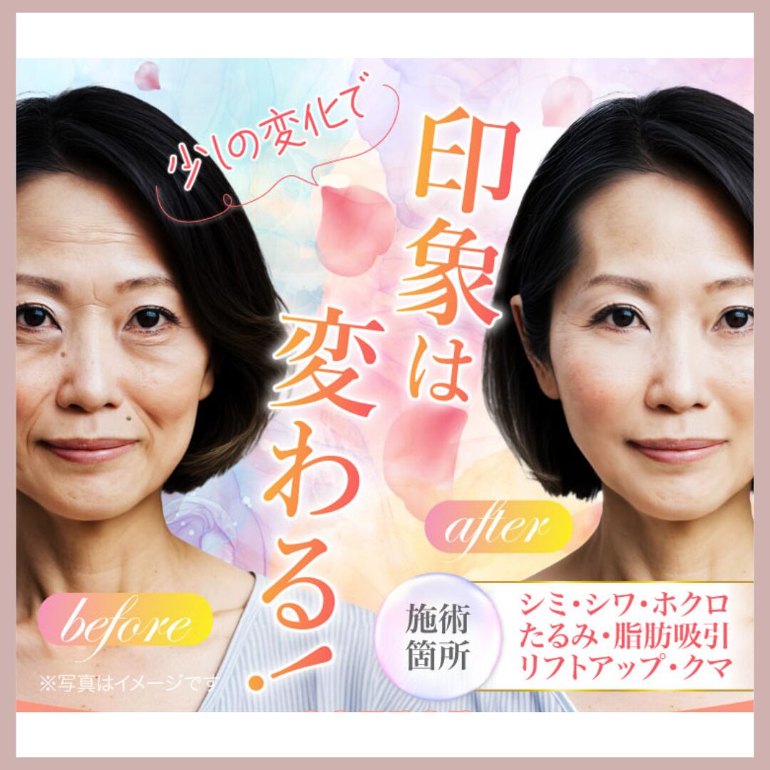 TCB東京中央美容外科