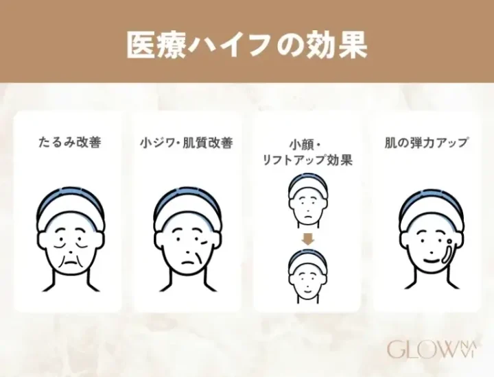 ハイフHIFUで期待できる効果