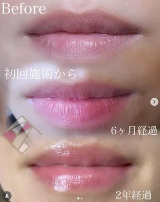 リップアートメイク