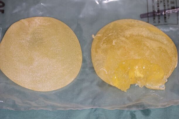 シリコンバッグの破損