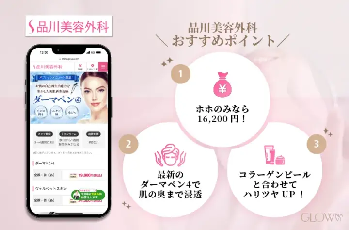 品川美容外科のダーマペンおすすめ広告。ホホのみ16,200円、最新のダーマペン4で浸透、コラーゲンピールとの組み合わせでハリがアップすることを紹介した図。