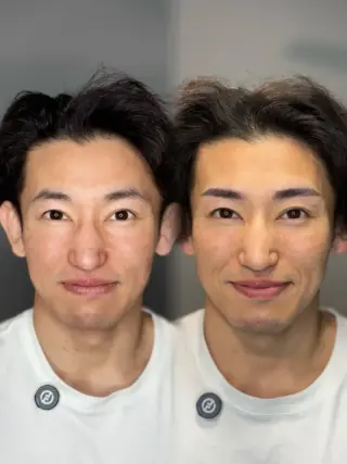 アートメイク