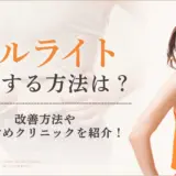 セルライト除去の方法は？自力でできる改善法とおすすめクリニック