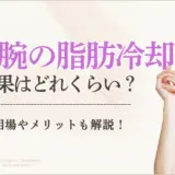 二の腕は脂肪冷却(クールスカルプティング)で痩せる？効果・メリット・注意点