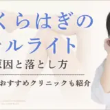 ふくらはぎのセルライトを落としたい！できる原因・予防法・解消法