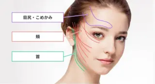 Rosa Beauty Clinic　糸リフト　施術メニュー画像