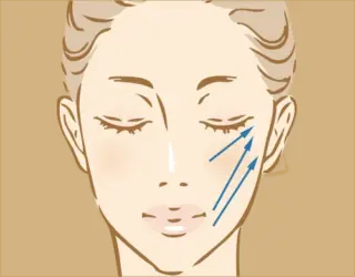 千里中央花ふさ皮ふ科・美容皮膚科 糸リフトの画像