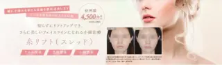 スワンクリニック銀座　糸リフト　施術メニュー画像