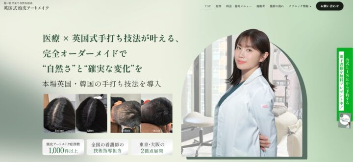 英国式頭皮アートメイクTOP画像