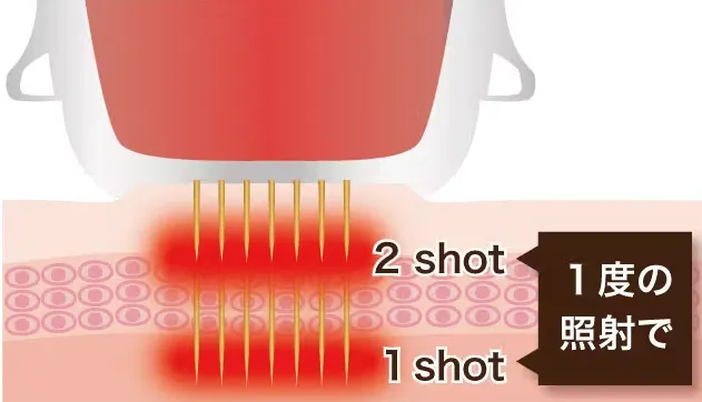 エリシスセンス ダブルショット機能