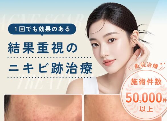 ライブリークリニック　サブシジョン　LP画像