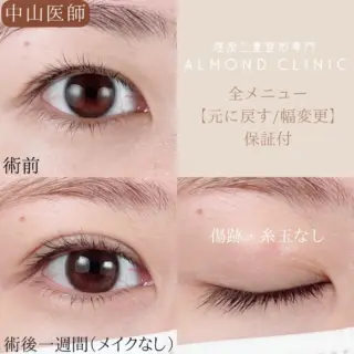 シークレットコスメ・シングル