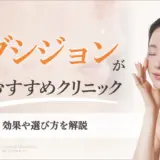 サブシジョン　安い アイキャッチ