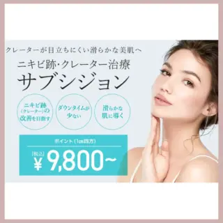 TCB東京中央美容外科サブシジョン