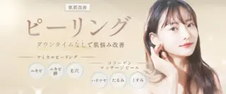 アーモンドクリニック ピーリングの画像