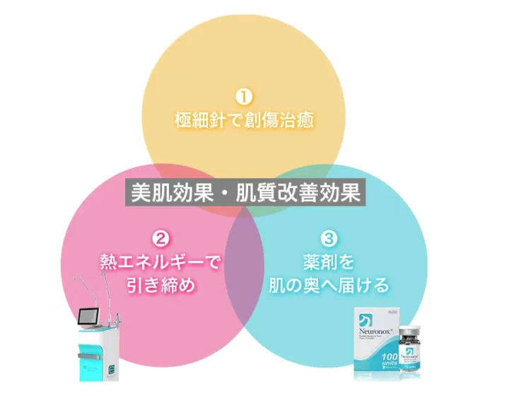 エリシスセンスとは 仕組みや効果について