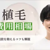 植毛　費用相場　アイキャッチ