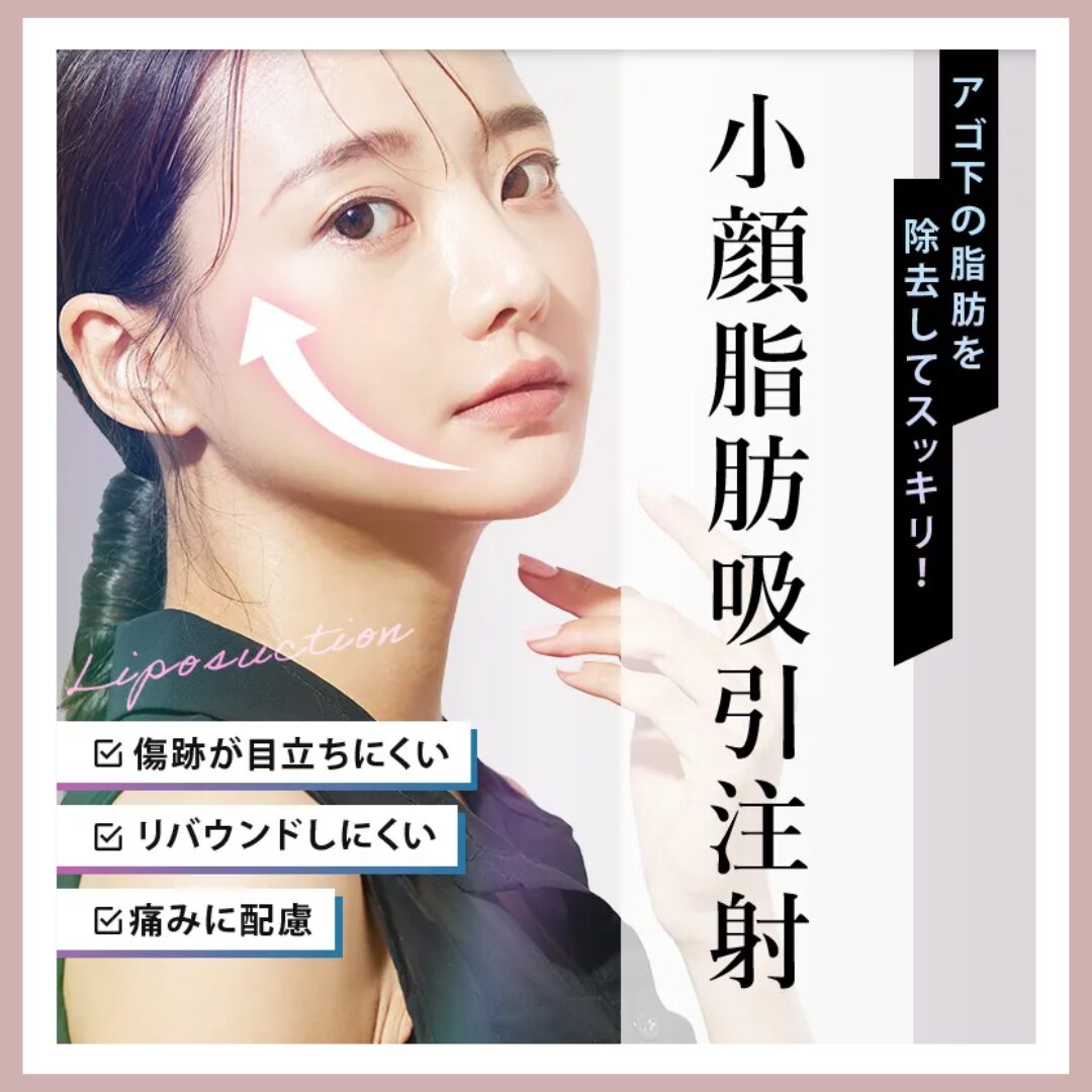 TCB東京中央美容外科