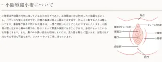 渋谷あおぞらクリニックの施術メニュー画像 小陰唇縮小術
